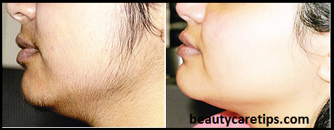 Blog post image