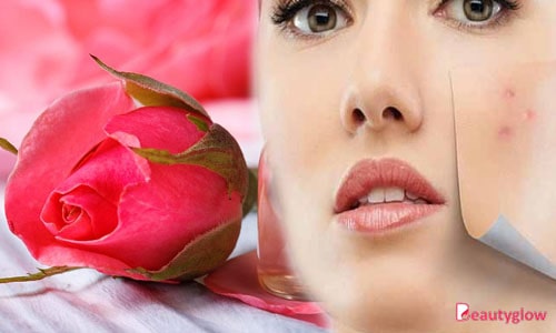 Blog post image
