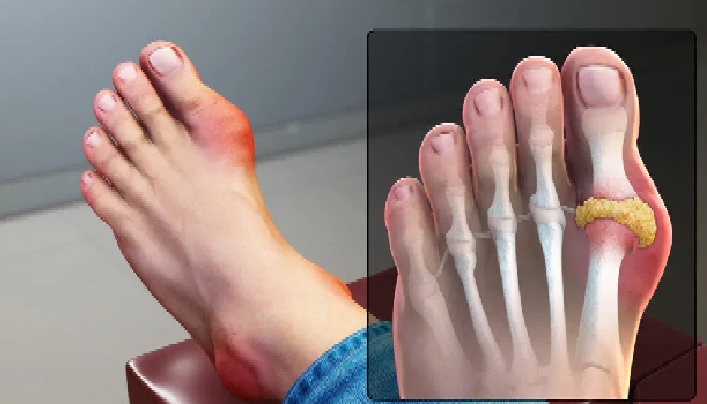 Blog post image